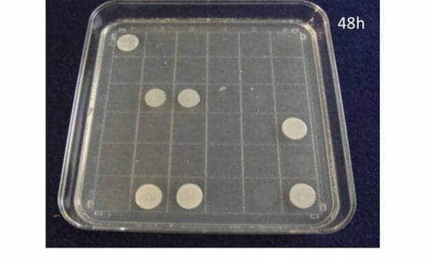 Santa Fe BioLabs Granted Patent for Identification System of Viable Candida auris