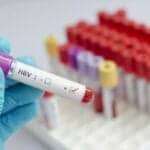 DiaSorin Receives FDA Approval On 6 Hepatitis B Tests