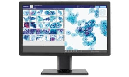 Hologic’s Genius Digital Diagnostics System for Cervical Cancer Screening Receives CE Mark