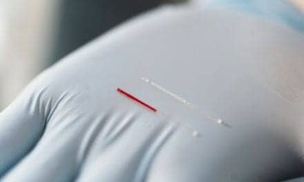 Dermal Interstitial Fluid Could Become New Source for Diagnostic Testing