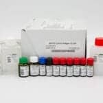 Novel ELISA for Detection of SARS-CoV-2 Antigen in Acutely Infected Covid-19 Patients