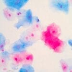 Viewpoint | Support for the Pap Test