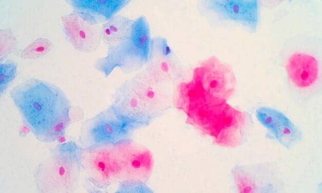 Viewpoint | Support for the Pap Test