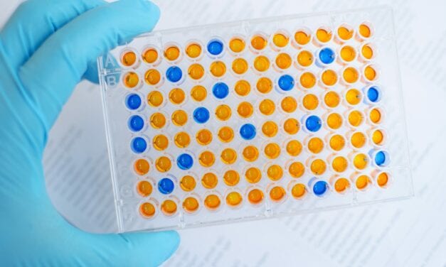ELISA Protocol for Covid-19 IgG Antibody Detection