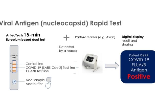 AnteoTech Developing POC Lateral Flow Tests for Covid-19 and Influenza