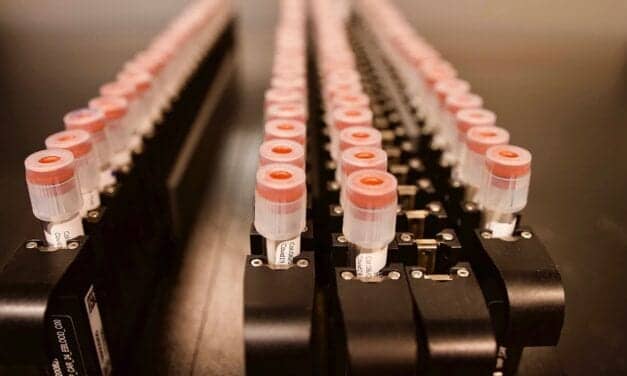 Novel Pooled Testing Strategy May Better Identify Covid-19 Infections