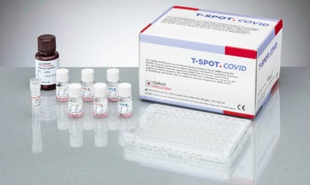 Oxford Immunotec Releases Test to Detect Cell-Mediated Immune Response to SARS-CoV-2
