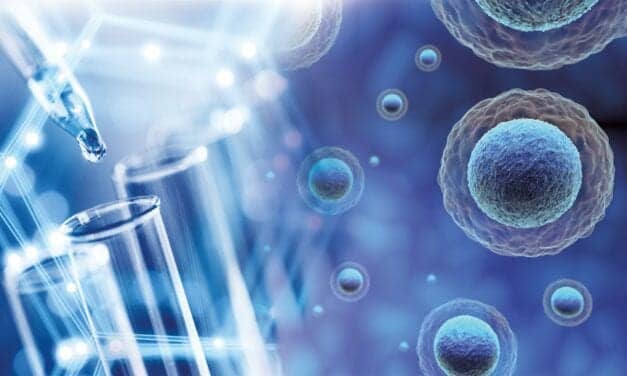High Recovery of Top-Quality Purified RNA