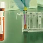Bio-Rad Launches InteliQ Diabetes Load-and-Go Quality Control