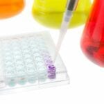 Urine Protein Biomarkers May Have Diagnostic Potential