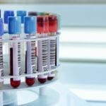 Harnessing Technology to Transform Workflow in the Blood Bank