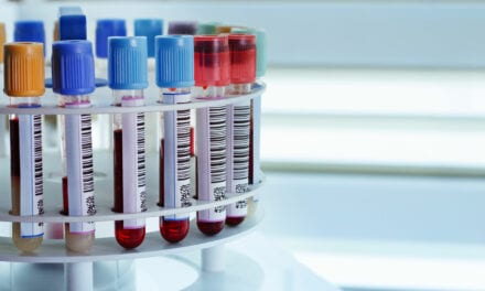 Harnessing Technology to Transform Workflow in the Blood Bank