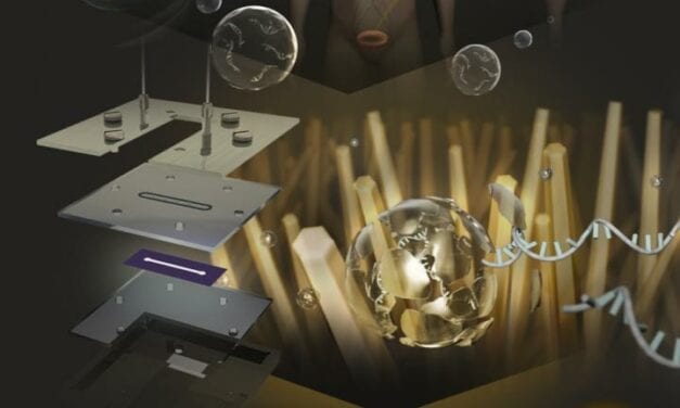 Urine Test May Aid Early Detection of Brain Tumors