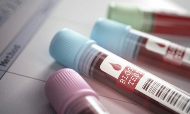 Exai Bio’s RNA-Based Liquid Biopsy Platform Detects Early Stage Breast Cancer Accurately