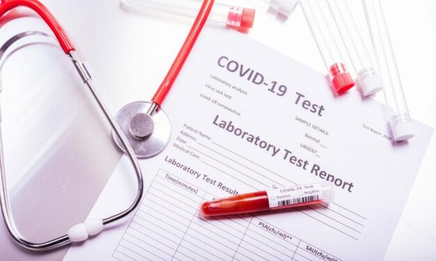 COVID Rapid Test Consistently Confirms Presence of Antibodies
