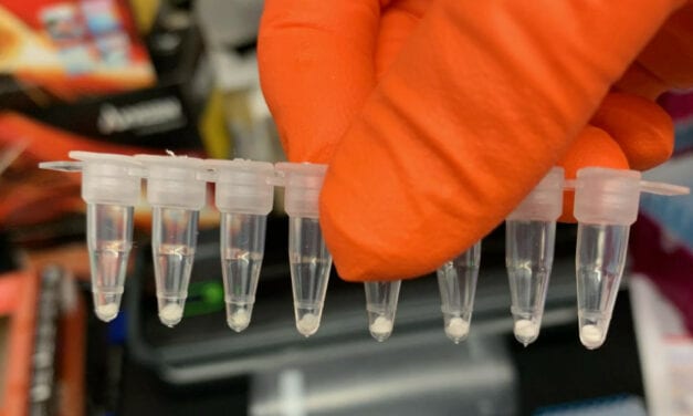 COVID-19 PCR Tests Can Be Freeze Dried