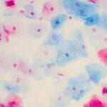 Women’s Health: Why Pap & HPV Cotesting Should Be Standard