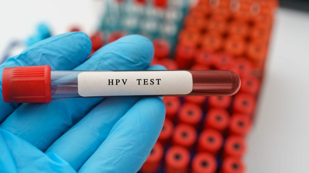 Womens Health Why Pap And Hpv Cotesting Should Be Standard Clinical Lab Products 9017