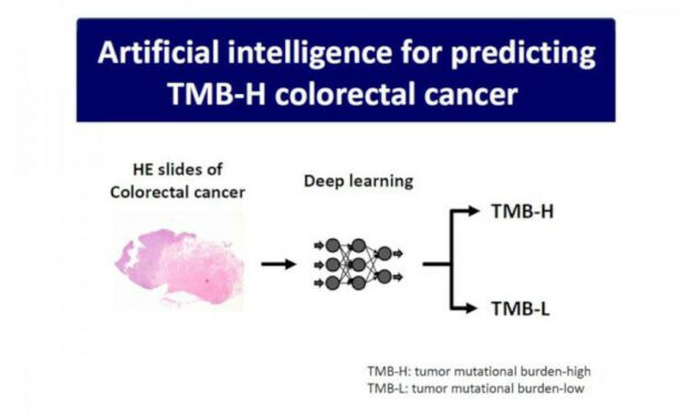 Histopathology-driven AI Predicts TMB-H Colorectal Cancer