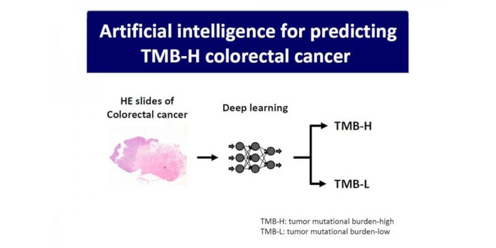 Histopathology-driven AI Predicts TMB-H Colorectal Cancer