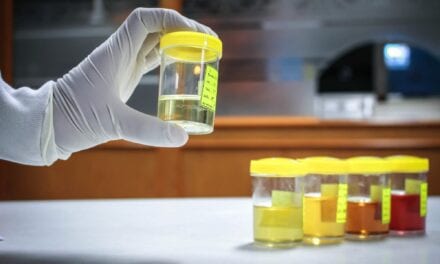 A Noninvasive Urine Test Can Detect Cancer Cells