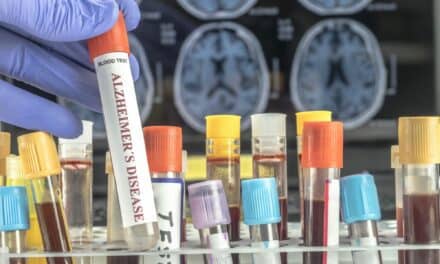 Plasma Biomarker Screening Could Improve Alzheimer’s Disease Diagnosis