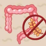 Beyond the Biopsy: Serological Testing Offers Greater Diagnosis Efficacy and Monitoring of Celiac Disease