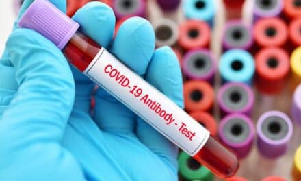 New York Approves SQI Diagnostics’ New COVID Antibody Test