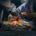 Prospera Heart Transplant Assessment Test Validated, Launched