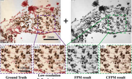 Fourier Ptychographic Microscopy May Transform Digital Pathology