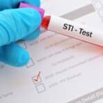 New CDC Guidelines Endorse Opt-Out Screening For 2 Most Common STIs