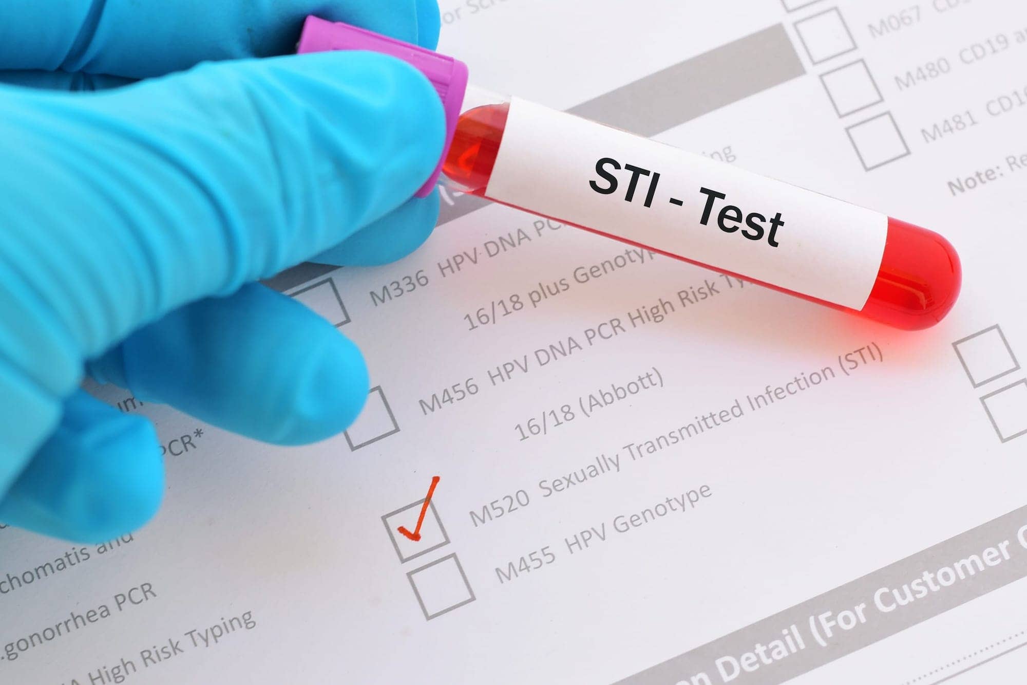 New CDC Guidelines Endorse Opt Out Screening For 2 Most Common STIs 