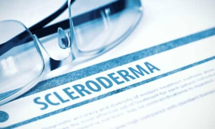 Potential Lung Disease Biomarker Discovered in Scleroderma Patients