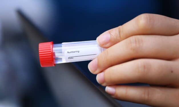 COVID-19: Saliva Test Almost as Accurate as Nose, Throat Swabs