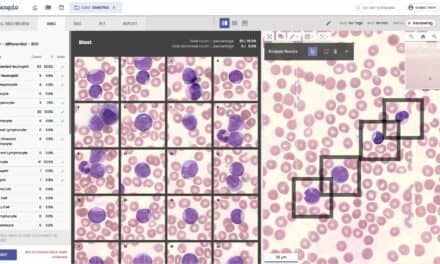 Scopio Labs Launches Full-Field Peripheral Blood Smear Application