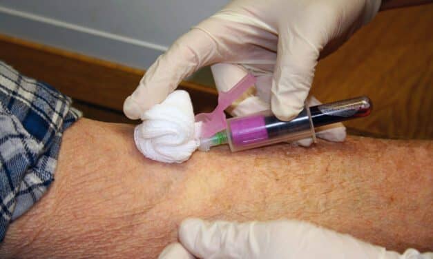 Dementia Risk Pinpointed in Blood Metabolites