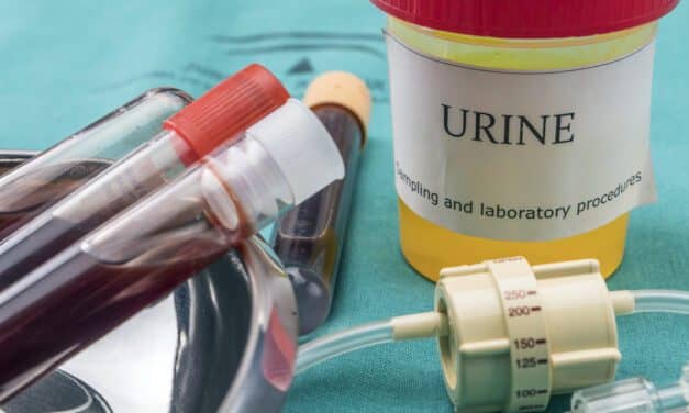 Urine DNA Test Detects Bladder Cancer Data Shows