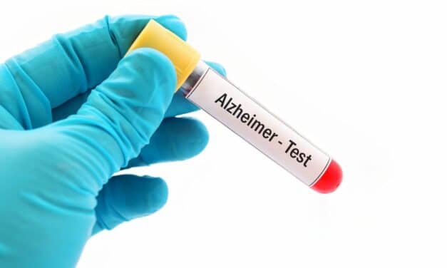 Researchers to Aim to Use New Blood Test to Prevent Memory Loss