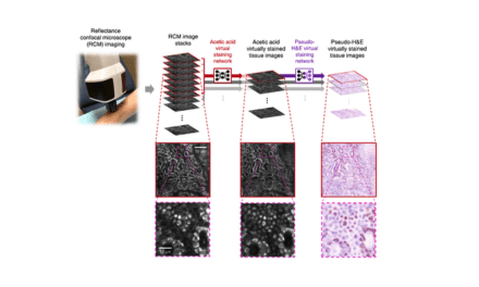 Virtual Histology Eliminates Need for Invasive Skin Biopsies