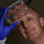 New Schistosomiasis Diagnostic Testing May Lead to its Eradication