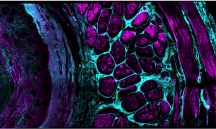 New Confocal Microscopy Platform May Help With Human Imaging