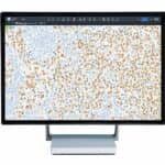 Roche Announces Release of AI-Based Digital Pathology Algorithms for Breast Cancer Patients