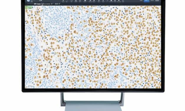 Roche Announces Release of AI-Based Digital Pathology Algorithms for Breast Cancer Patients