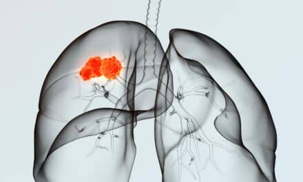 Blood Drops May Help Detect Early-Stage Lung Cancer