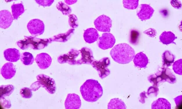 NeoGenomics to Leverage Thermo Fisher Sequencing Solution in Myeloid Cancer Study