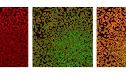 Olympus scanR High-Content Screening Station Improves Deep-Learning Capabilities