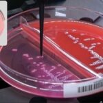 Colibri Automated Specimen Workup Instrument Receives FDA 510(k) Clearance