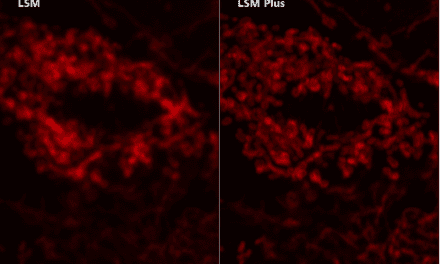 ZEISS’ New Software Improves Laser Scanning Microscopes