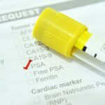 How the Pandemic Impacted Prostate Cancer Diagnostics