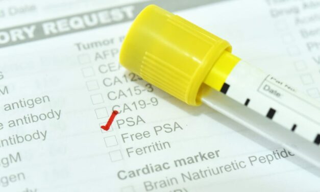 How the Pandemic Impacted Prostate Cancer Diagnostics